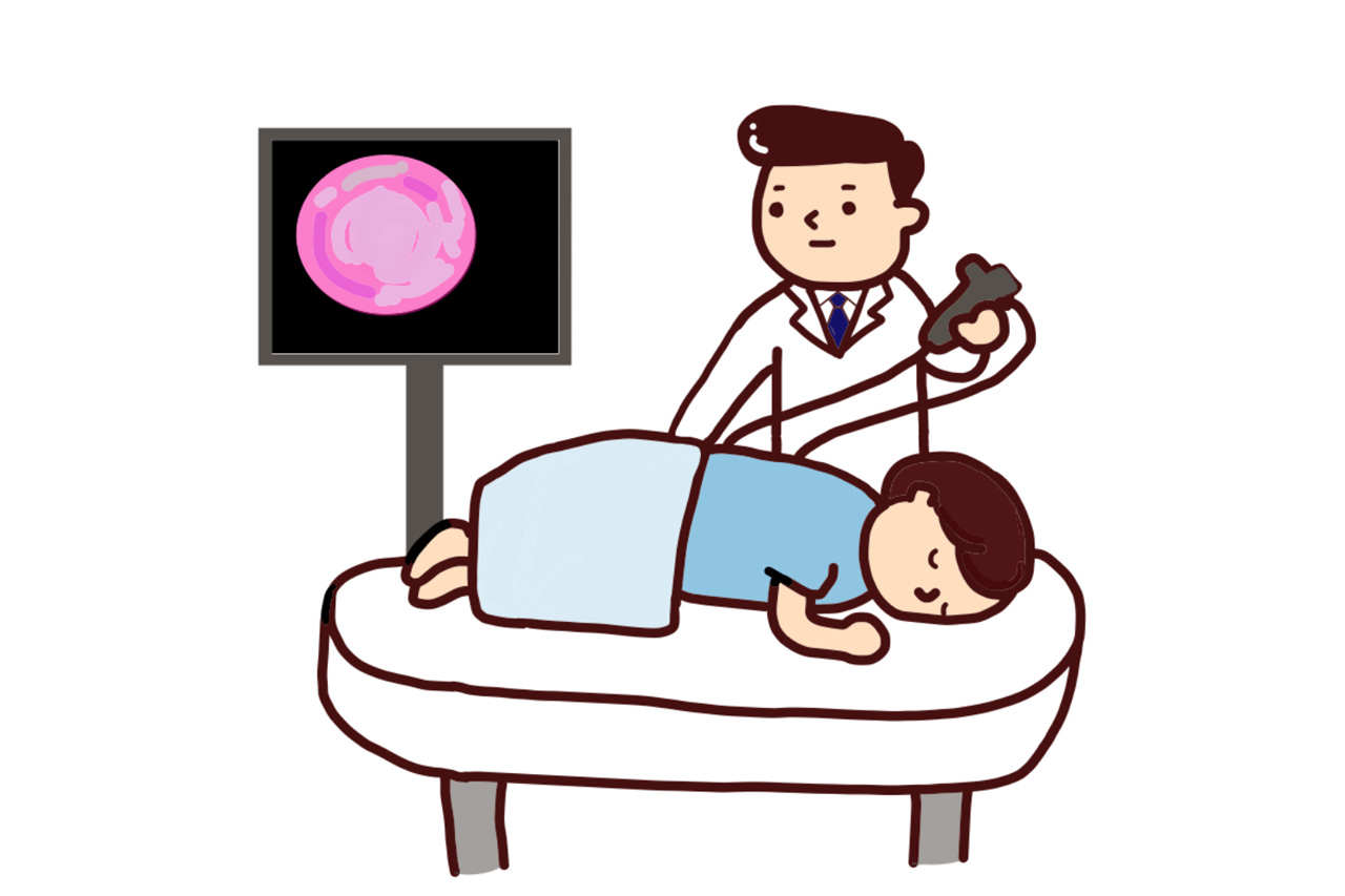 札幌駅で大腸内視鏡検査を受けるなら ～快適な検査を提供するさっぽろ駅前内科・内視鏡クリニックへ～